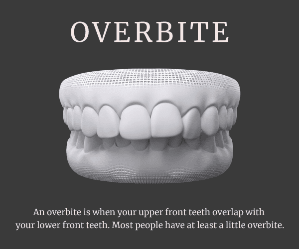 overbite
