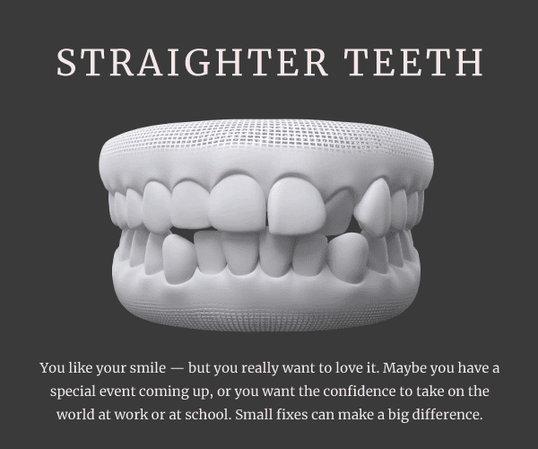 straighter-teeth